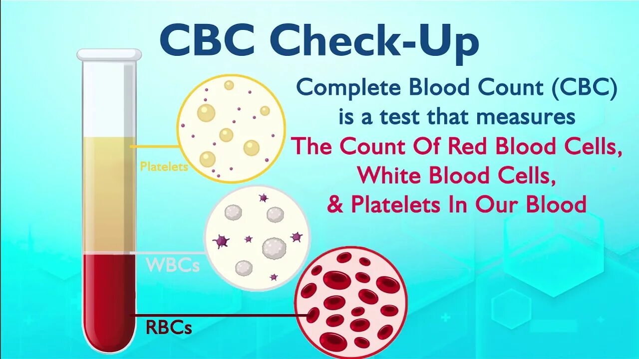 Complete Blood count. CBC Test. Complete Blood count Test. Lab Test CBC.