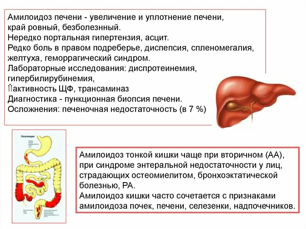 Увеличен край печени. Амилоидоз печени исход. Амилоидоз печени клиника. Амилоидоз печени и почек.