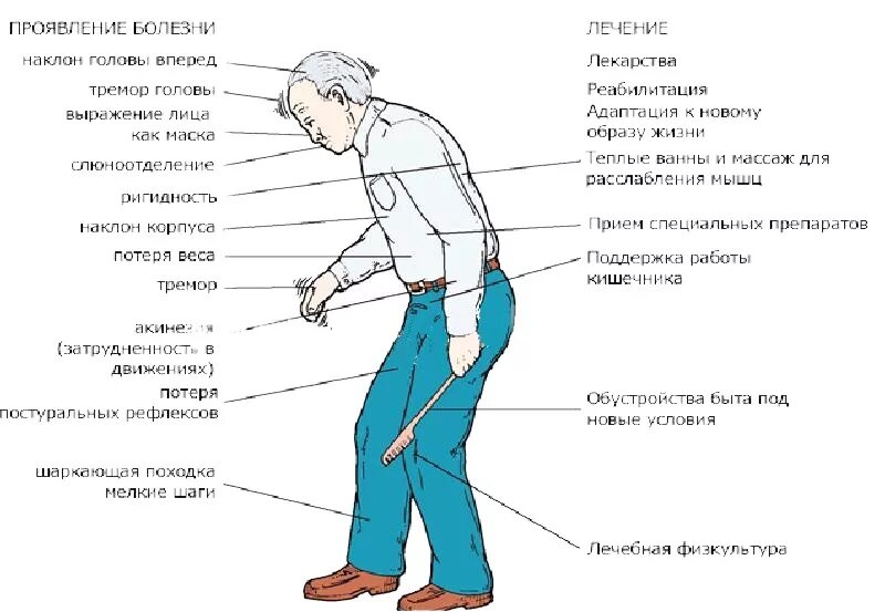 Почему шатает при ходьбе
