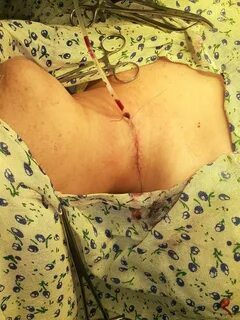 Ушбу жарроҳлик амалиётидан кейин бемор аҳволи яхшиланиб, у ҳозирда... 