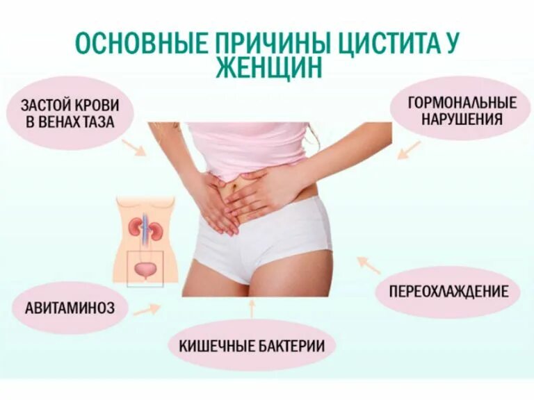 Цистит симптомы причины. Хронический цистит у женщин симптомы. критерии хронического цистита. хронический цистит симптомы.