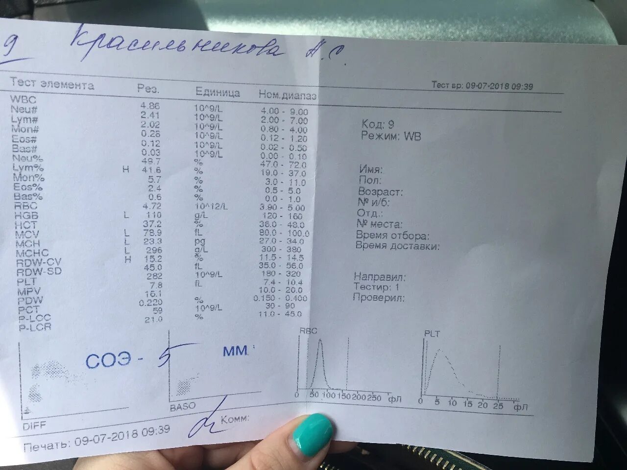 Иммуноглобулин е как сдавать. Анализ на иммуноглобулин е. Результат анализа на иммуноглобулин е. Биохимический анализ крови иммуноглобулин е. Как выглядит анализ на иммуноглобулин е.