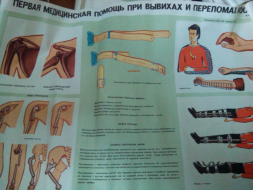 Вывих наложение шины. Наложение шины дитерихса. наложить шину дитерихса. шина дитерихса накладывается при переломах. наложение шины дитерихса алгоритм.