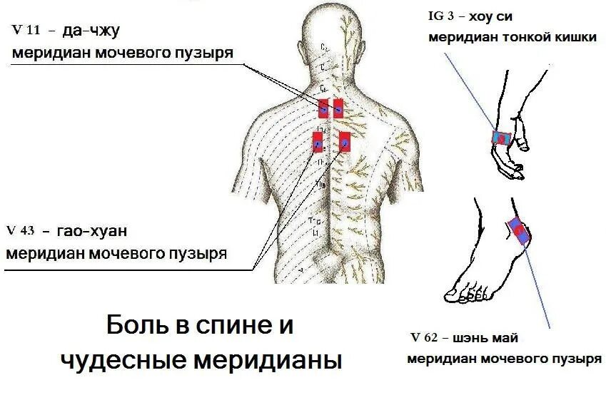 Схема боли в спине. Точки акупунктуры при боли в пояснице. Точка v62 Шэнь-май. Акупунктурные точки на теле человека от боли в пояснице.