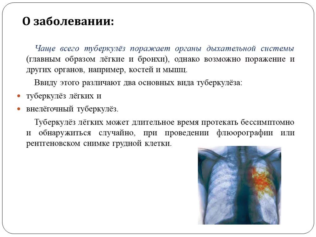 При туберкулезе чаще поражаются