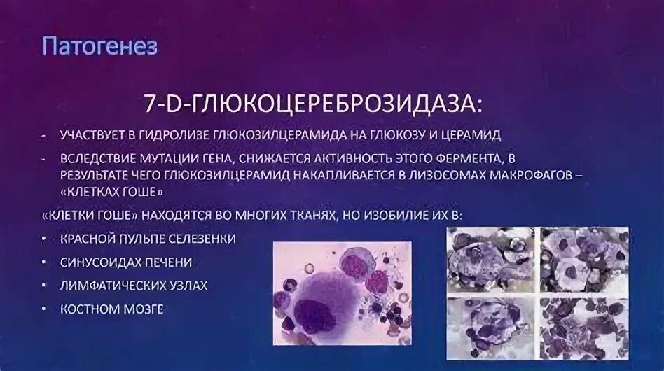 Болезнь гоше эпидемиология. Болезнь гоше микропрепарат селезенки. Болезнь гоше патанатомия. Селезенка при болезни гоше. Болезнь гоше препараты.