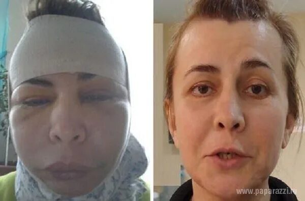 Типы опухолей челюстей, причины развития и прогноз лечения