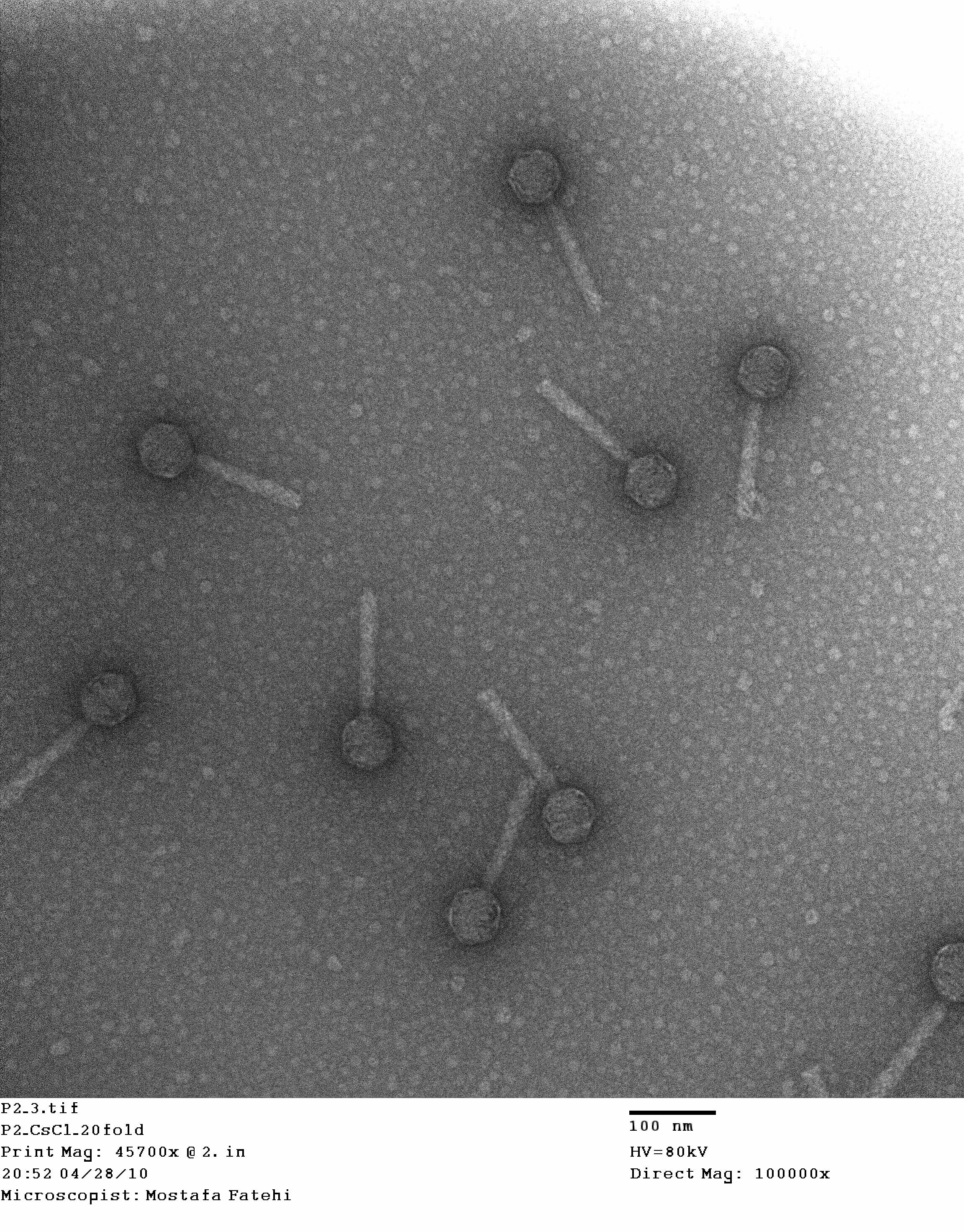 Бактериофаги Myoviridae. Бактериофаг в электронном микроскопе. Бактериофаг эшерихия. Бактериофаг под микроскопом. P virus