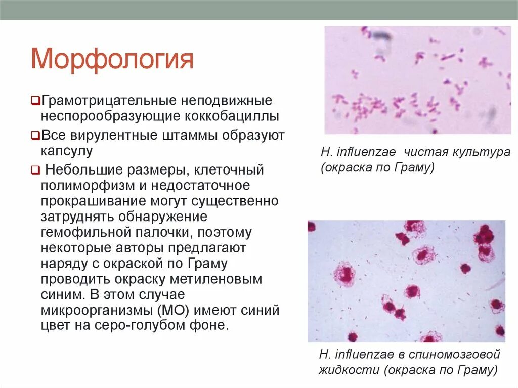 Haemophilus в мазке у мужчин. Haemophilus influenzae морфология. Гемофильная палочка микробиология морфология. Гемофильная инфекция морфология. Гемофильная палочка мазок.