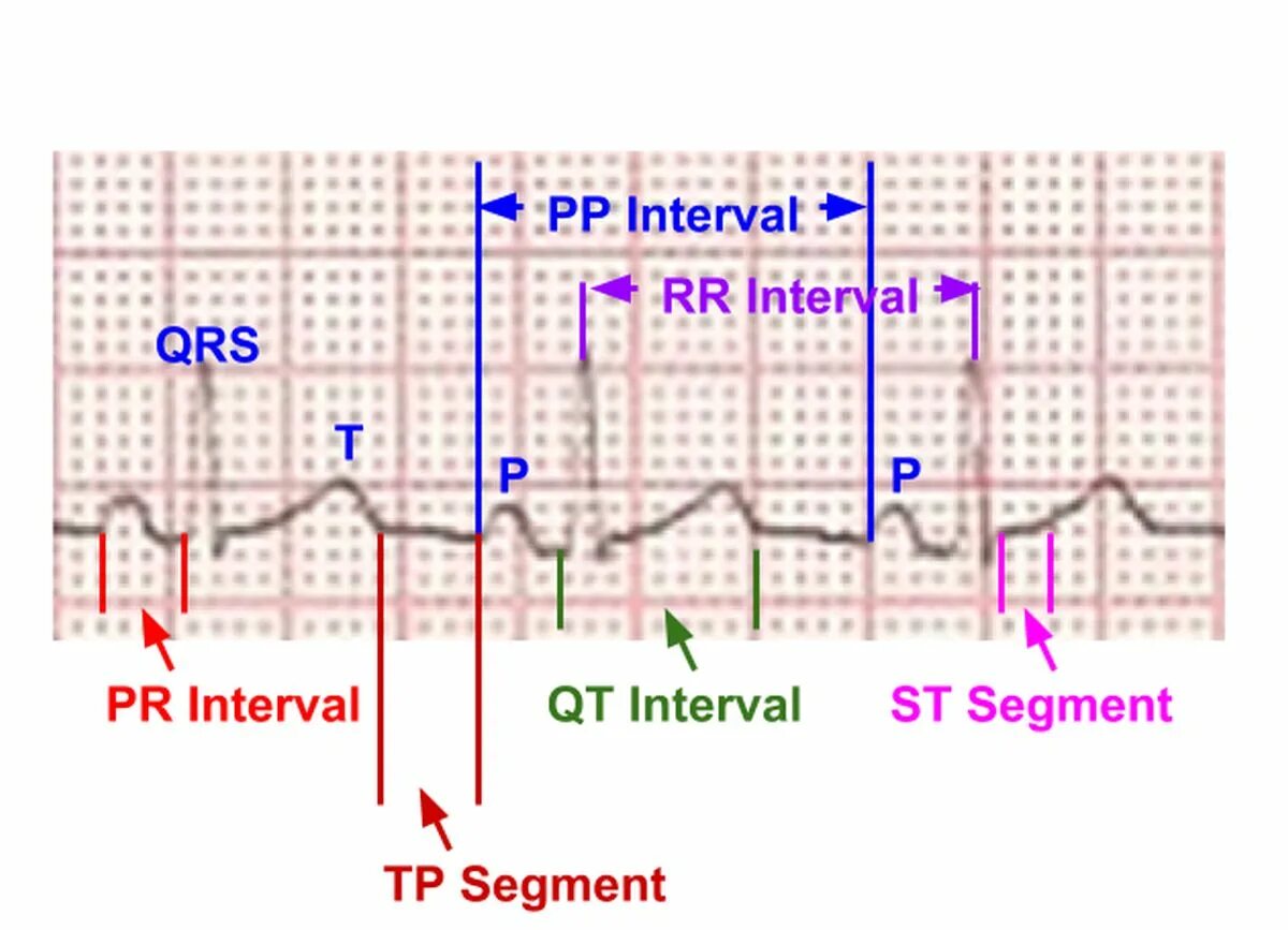 Re load interval 500 re upload interval. Что значит PR and St segment in ECG. Методика short Interval s SIM. Coordinate System and Design of the Cardiac electrical Axis. Segment TP.