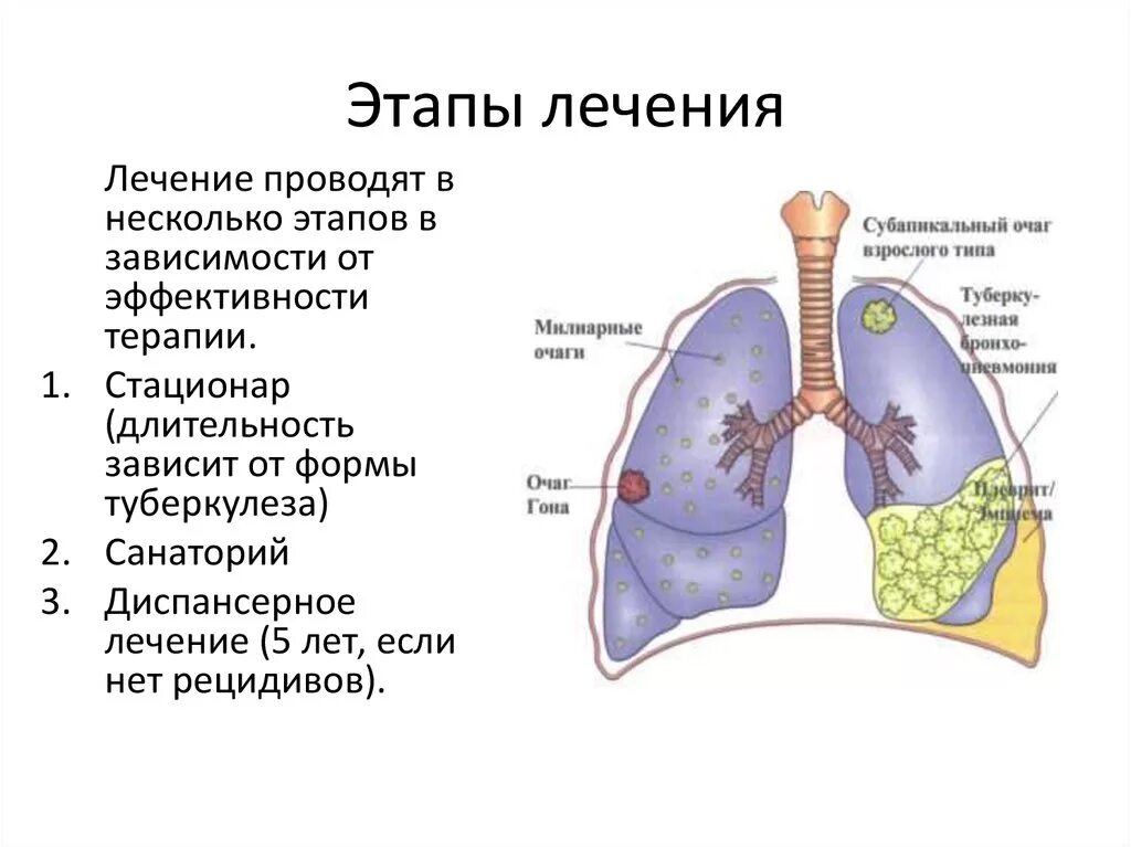 Проводят в несколько этапов. Туберкулез легких презентация. Туберкулез легких лечится. Туберкулез органов дыхания.
