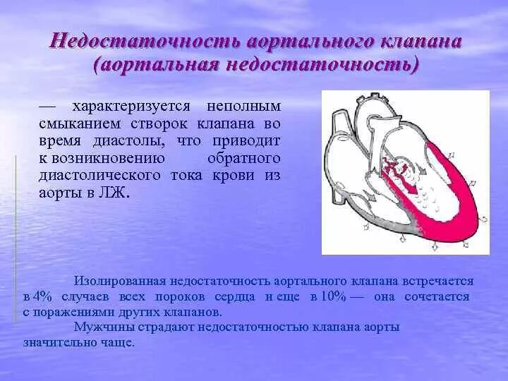 Прогиб створок митрального клапана. Пролапс створки митрального клапана. пролабирование створки аортального клапана. пролапс некоронарной створки аортального клапана. аортальная недостаточность и пролапс митрального клапана.