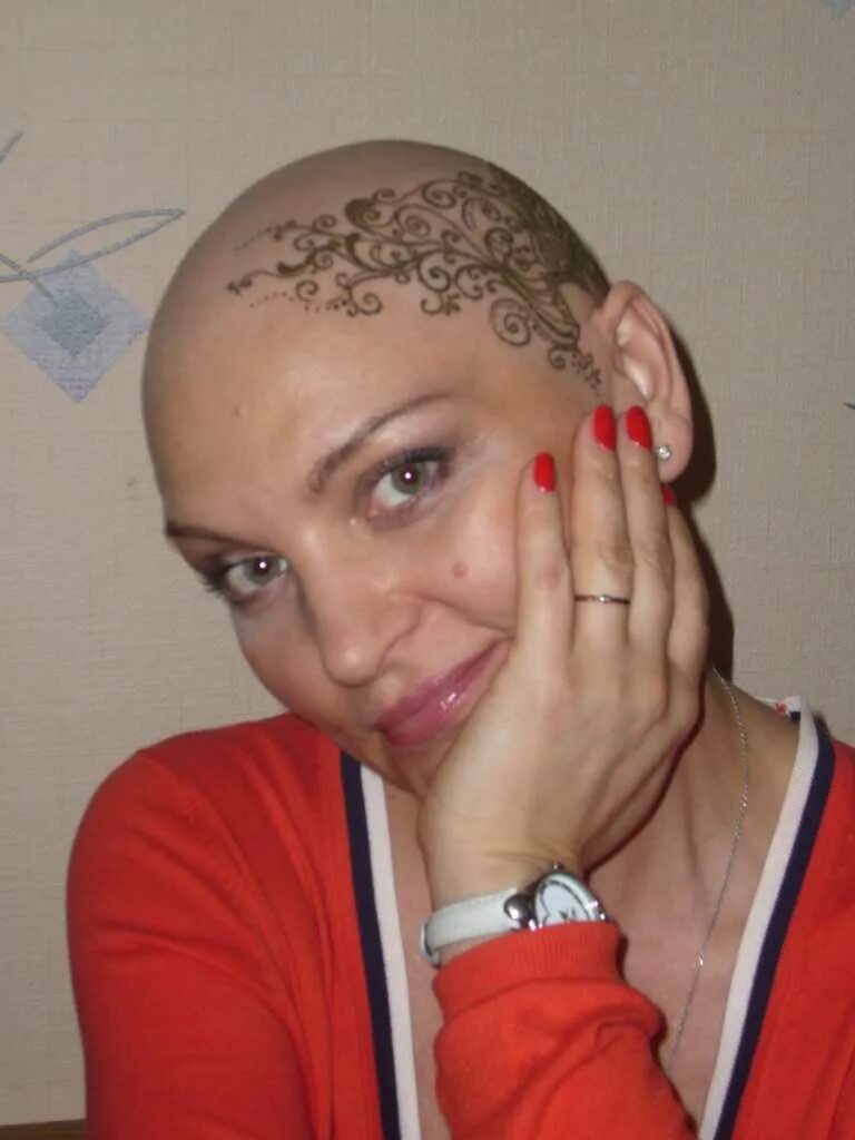 волосы после химиотерапии. женщины после химиотерапии фото. отрастание волос после химиотерапии. макияж после химиотерапии. хна для волос до и после.