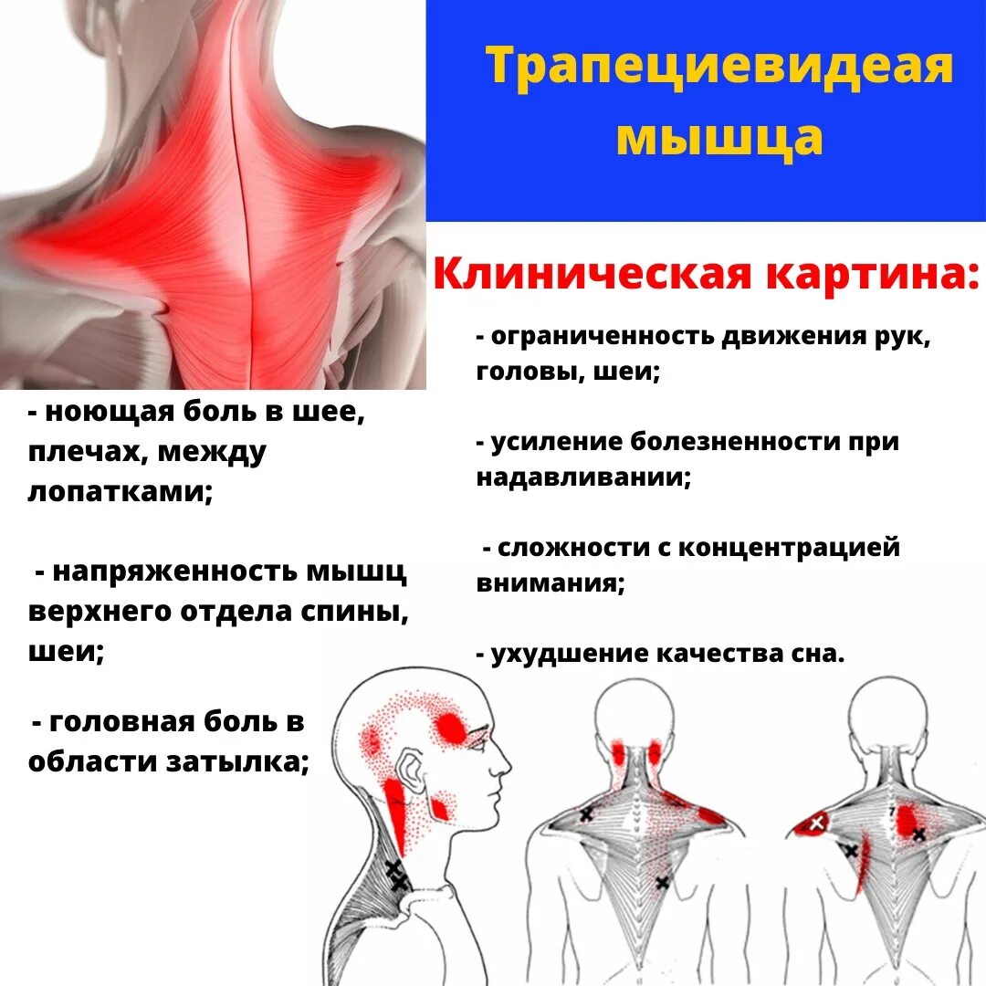 Ноющая боль в верхней части