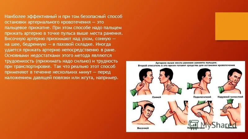 Пальцевое прижатие височной артерии. Височное пальцевое прижатие. Пальцевое прижатие подключичной артерии. Точка пальцевого прижатия лицевой артерии. Пальцевое прижатие височной артерии.