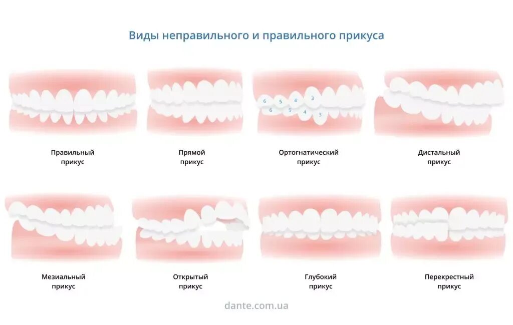 Нижний насколько. Прикус неправильный нижней челюсти зубов. Правильный прикус вид сбоку. Правильный прикус у человека сбоку. Идеальный прикус зубов сбоку.