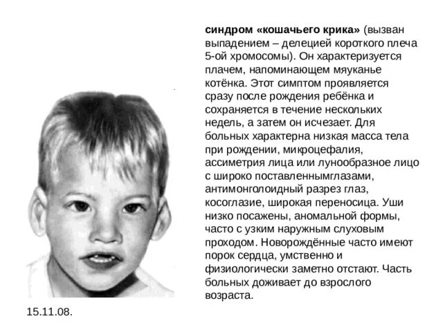 Кошачья болезнь у детей