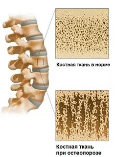 Состояние кости
