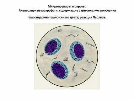 Альвеолярные макрофаги норма