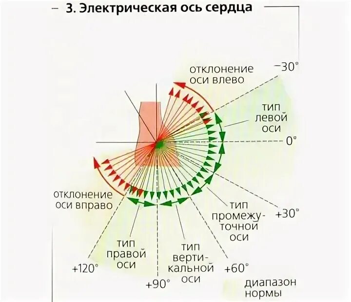 Электрическая ось сердца на ЭКГ. Оси ЭКГ таблица. Определение электрической оси сердца на ЭКГ таблица. Отклонения электрической оси сердца по ЭКГ. Сердце отклонено вправо