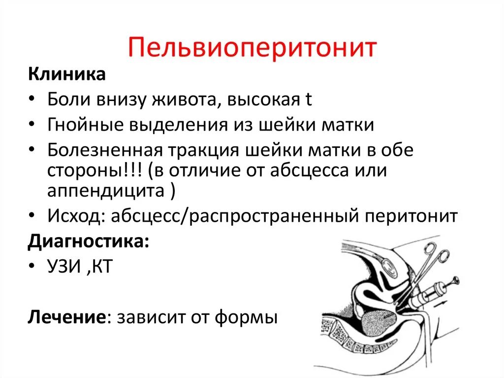 После гинеколога болит низ живота. Послеродовый пельвиоперитонит. Пельвиоперитонит клиника. Пельвиоперитонит в гинекологии. Первичный пельвиоперитонит.