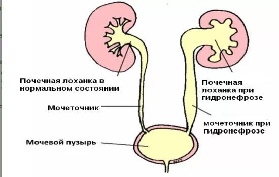 Почечная лоханка строение и функции. Почечные чашки лоханка мочеточники. Чашечно-лоханочная система почки. Строение чашечно лоханочной системы почек. Строение лоханки