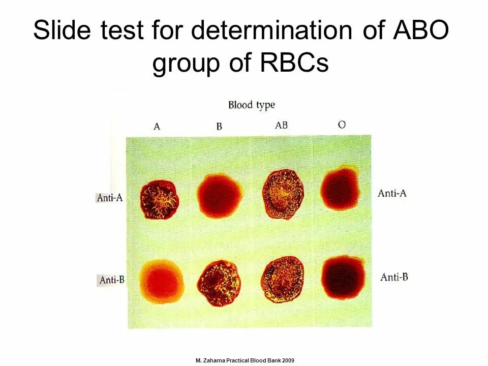 Как по английски кровь. Blood Group Test. Blood Test название. Determination of Blood Groups. Blood Type determination.