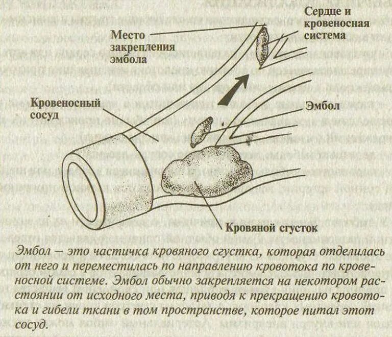 Почему у алкоголиков болят ноги