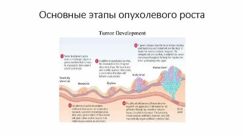 Опухолевый