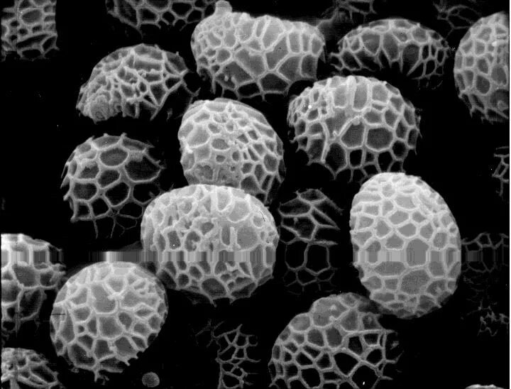 Споры мухомора под микроскопом. Споры грибов под микроскопом. Споры шампиньонов под микроскопом. Грибная спора под микроскопом. Споры грибов семена