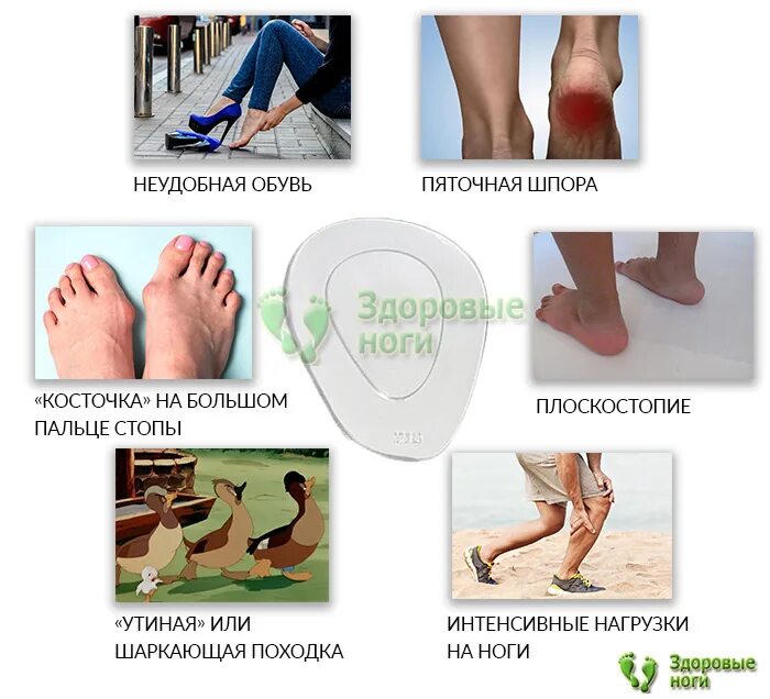 Подвижность стопы. Подвижность стопы. Углы сгибания и разгибания в голеностопном суставе. Угол сгибания голеностопного сустава. Плоскостопие лфк комплекс упражнений.
