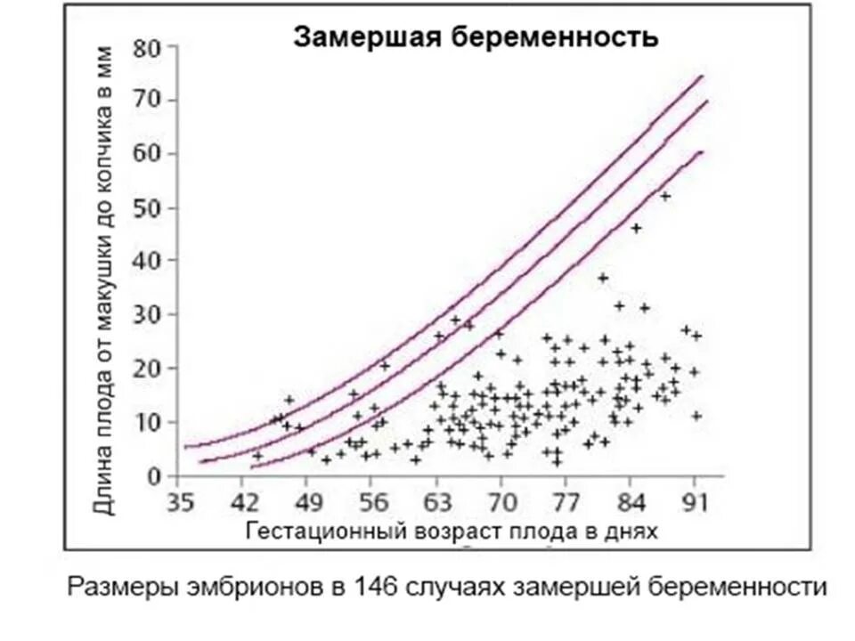 Риски замершей беременности во втором триместре. Риск замершей беременности по неделям. Статистика замерших беременностей по неделям. Статистика по замершей беременности по неделям.