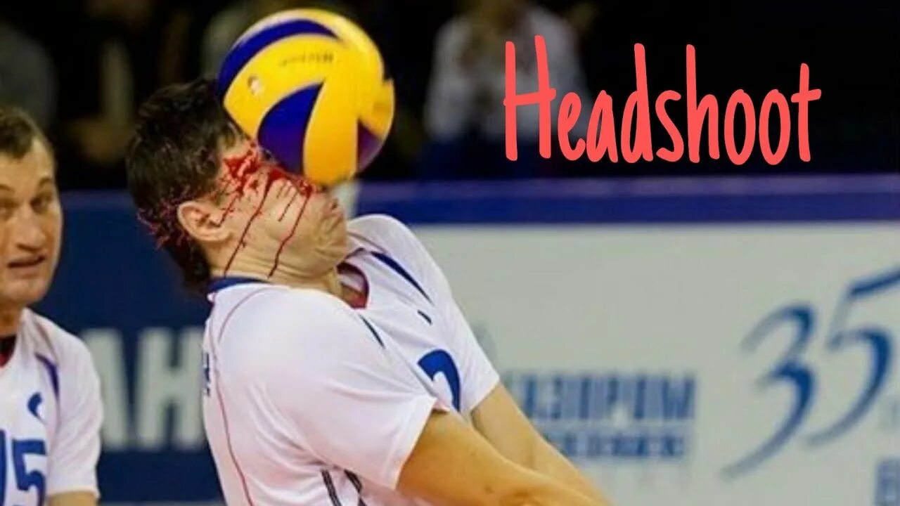 Что такое эйс в волейболе. Волейбольный мяч в лицо. Травмы в волейболе. Волейбол смешные моменты. Мяч для волейбола.