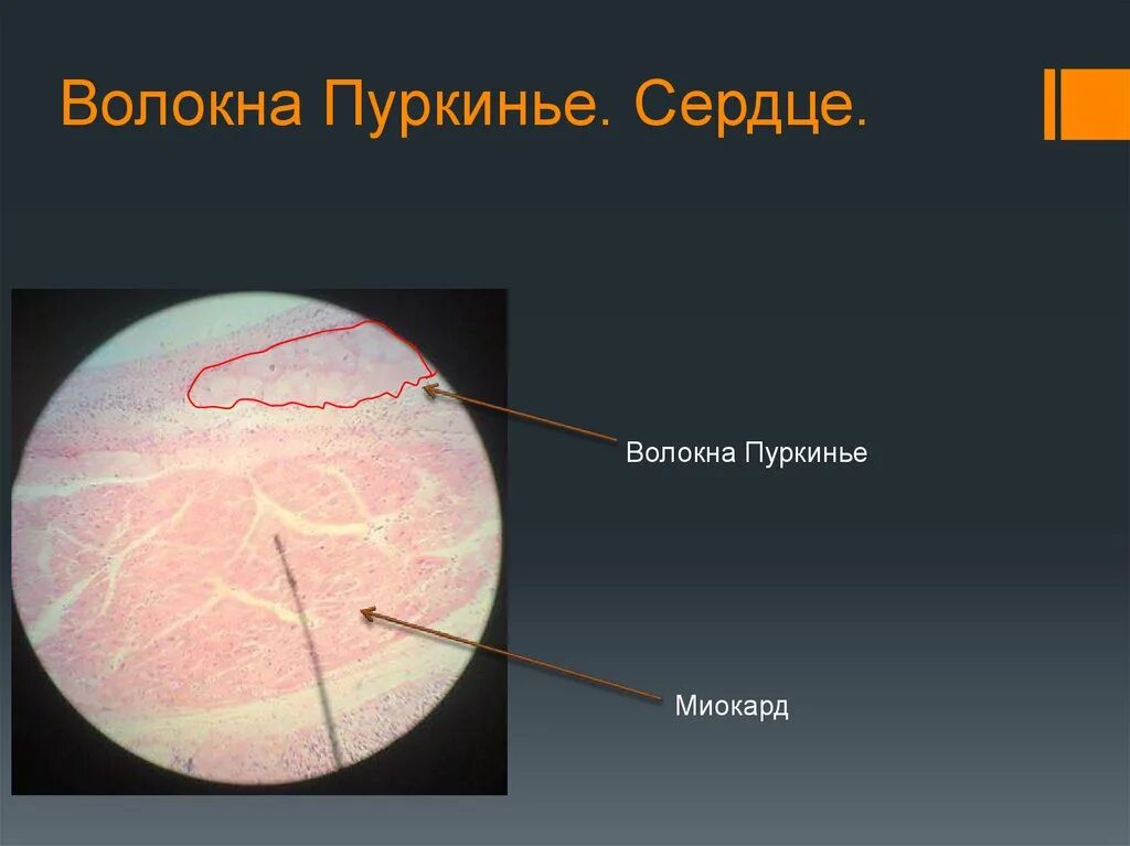 Пучок пуркинье. Волокна Пуркинье в сердце гистология. Волокна Пуркинье препарат гистология. Волокна Пуркинье в стенке сердца гистология препарат. Волокна Пуркинье сердце быка препарат.