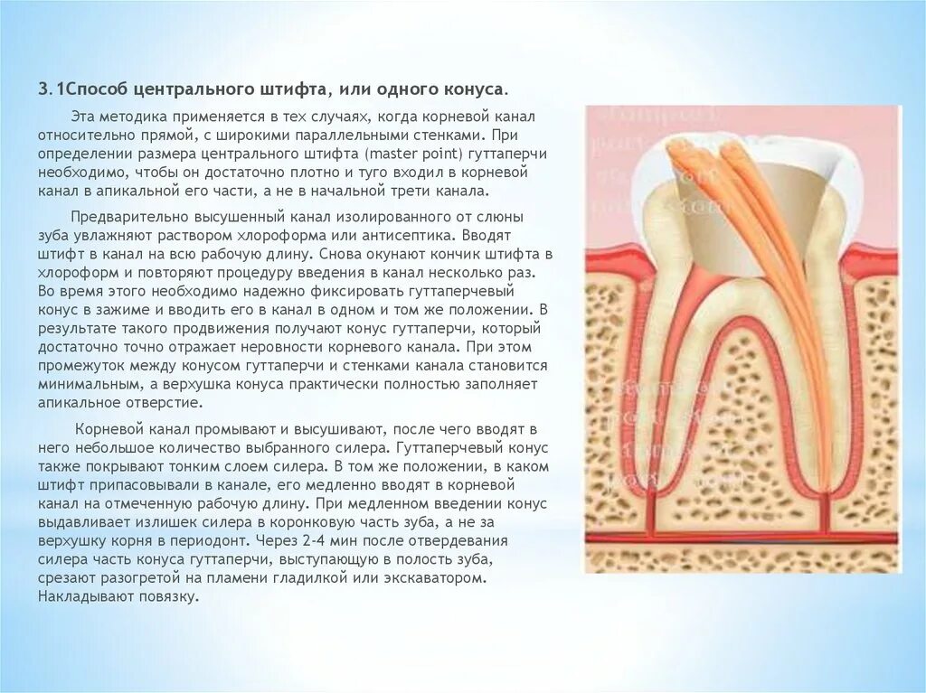 1 корневой канал. Штифт канал гуттаперча. Методика пломбирования корневых каналов гуттаперчевыми штифтами. Пломбирование корневого канала зуба гуттаперчевыми штифтами 1 к/к. Пломбировка каналов гуттаперчей методика.