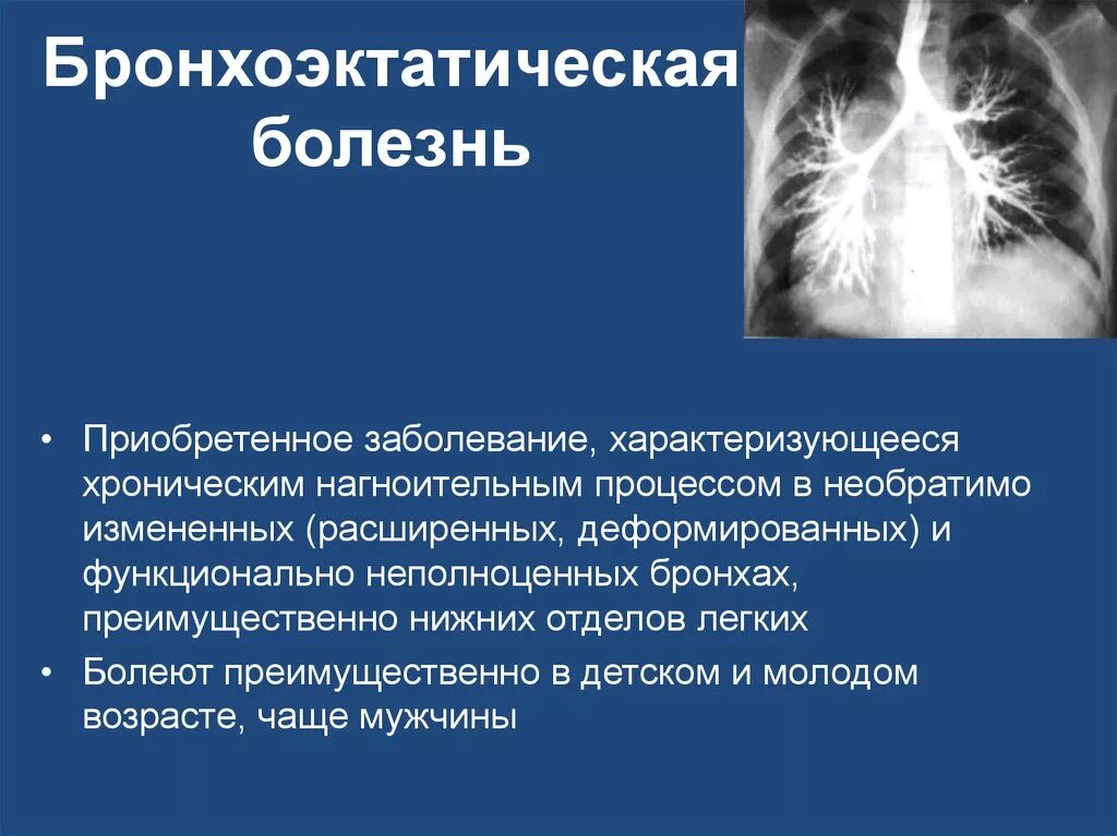 Бронхит бронхоэктатическая болезнь. Бронхоэктатическая болезнь пропедевтика. Бронхоэктатическая болезнь эритроцитоз. Деструктивные пневмониты бронхоэктатическая болезнь. Клинические симптомы бронхоэктазов.