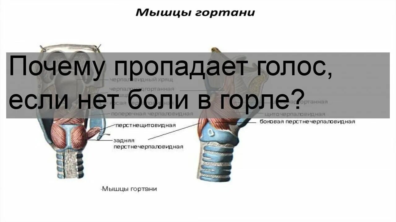 Пропавший голос. Если пропал голос. Отчего пропадает голос. Потеря голоса причины