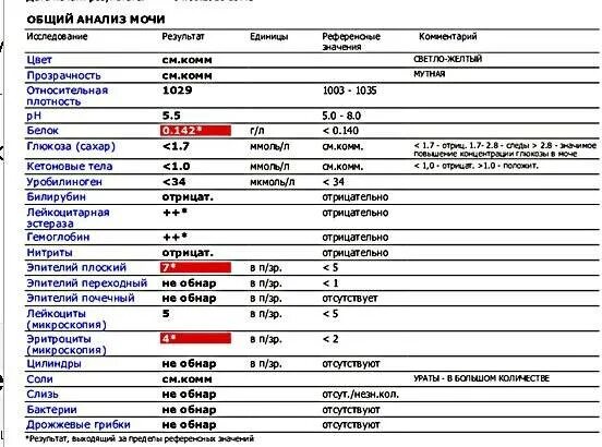 Лейкоциты в моче мкл норма. Норма лейкоцитов в моче в 1 мл. Норма лейкоцитов в моче в 1 мкл. Уровень лейкоцитов в 1 мл мочи в норме. Лейкоциты качественно что это значит