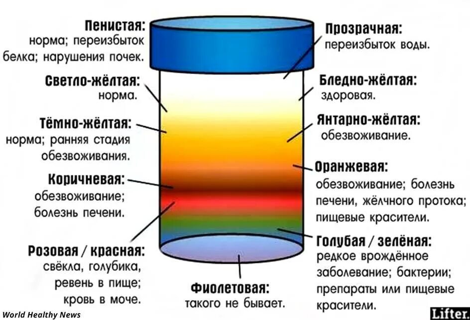 Какой должна быть моча в норме. Тёмно жёлтая моча у мужчин причины. Цвет мочи норма. Моча нормального цвета. Narmalni Cvet machi.