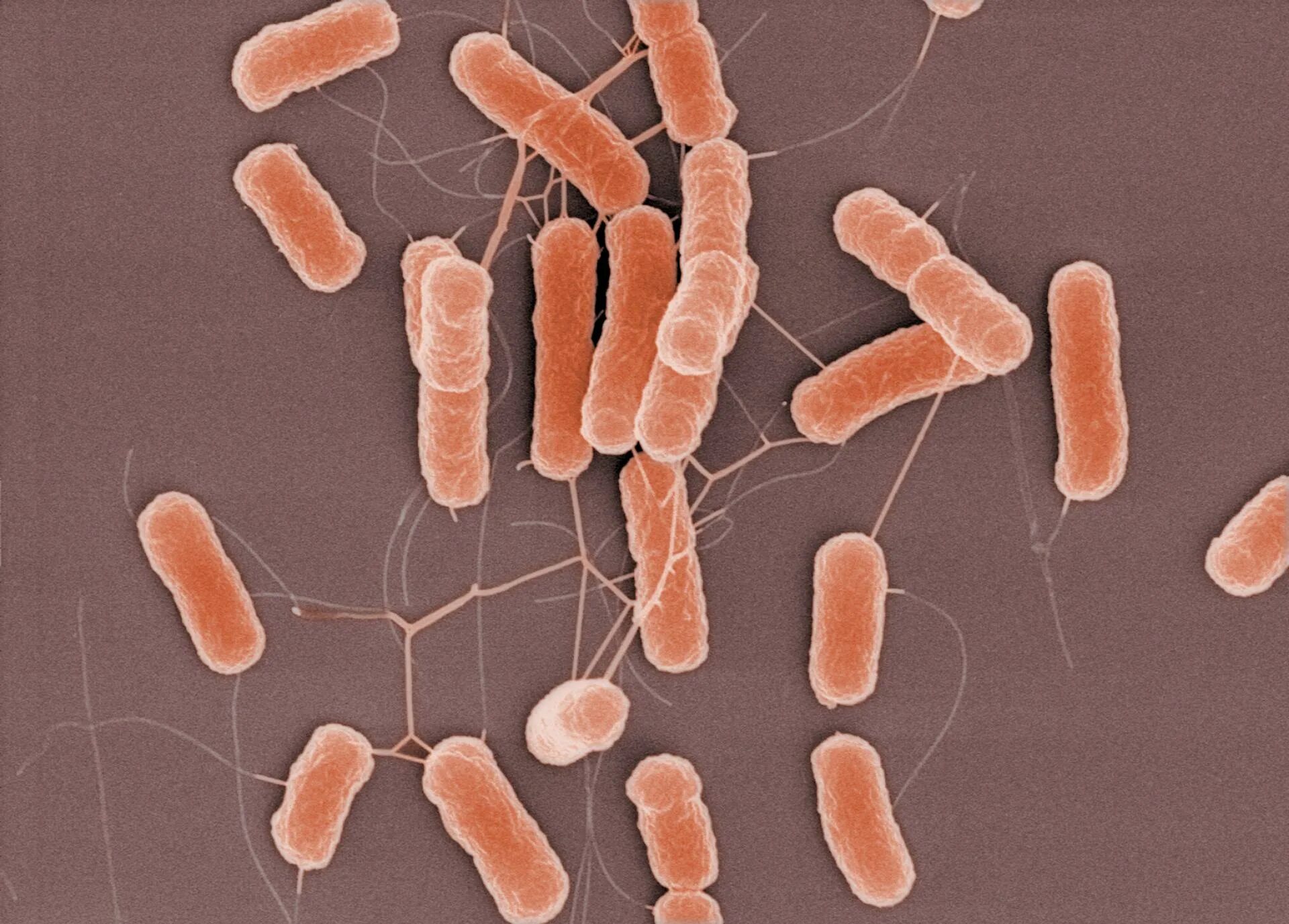 Кишечные палочки какая группа. Кишечная палочка Escherichia coli. Эшерихия кишечная палочка. Бактерия кишечной палочки Escherichia coli. Эшерихии группа бактерий.