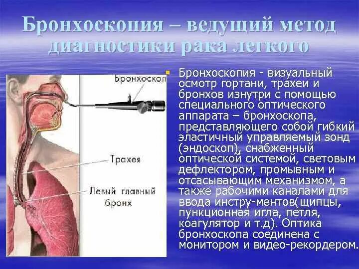 Бронхоскопия мокроты. Бронхоскопия и бронхография. Методы исследования гортани трахеи и бронхов.