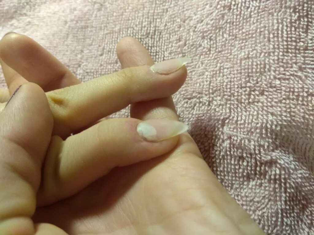 Наращивание пальца. Ногти самоучек. Нарощенные ногти горе Мастеров. Ужаснейшие нарощенные ногти от Мастеров самоучек. Мастера самоучки ногти.