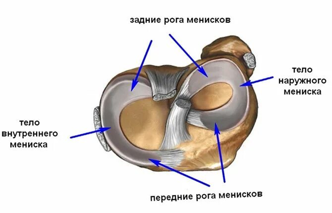 Повреждение коленного сустава 3 степени. Разрыв заднего рога медиального мениска 3 степени. Повреждение мениска медиального мениска. Разрыв рога латерального мениска 3 степени. Повреждение заднего рога внутреннего мениска 3 степени.