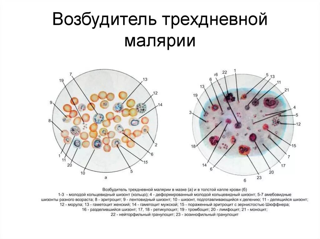 Возбудитель болезни малярии. Мазок крови больного трёхдневной малярией. Трехдневная малярия строение. Малярийный плазмодий возбудитель трехдневной малярии. Малярии в препарате мазков крови морфология.