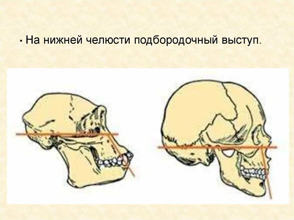Мозг гориллы и человека. Череп шимпанзе и человека. Сравнение черепа человека и шимпанзе. Череп человека и обезьяны отличия.