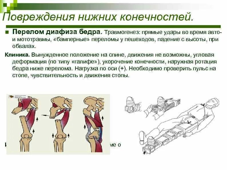 Деформация при переломе бедренной кости. Перелом бедренной кости клиника. Перелом диафиза бедренной кости классификация.