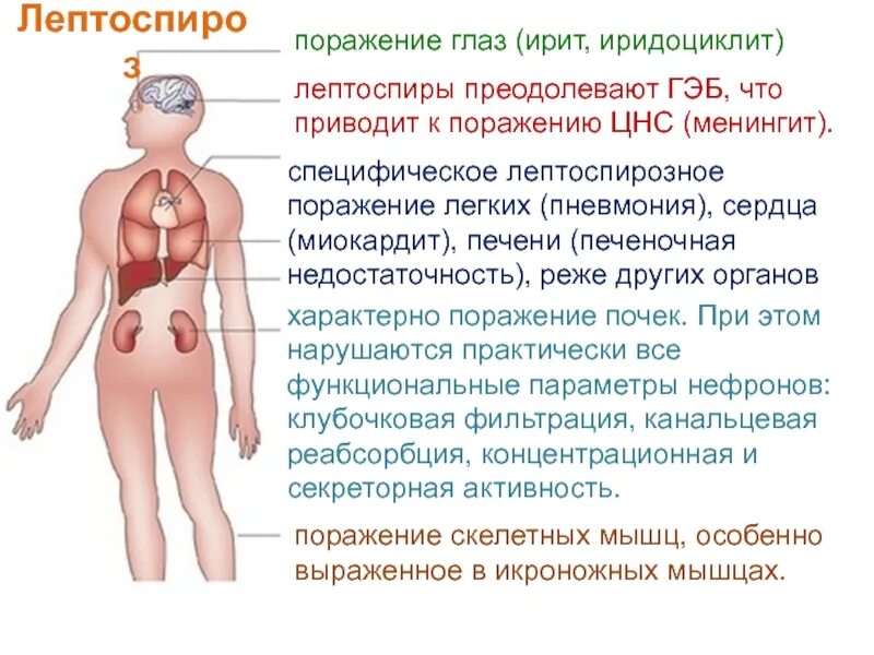 Лептоспироз почки. Лептоспироз поражение почек. поражение печени при лептоспирозе. формы лептоспироза.