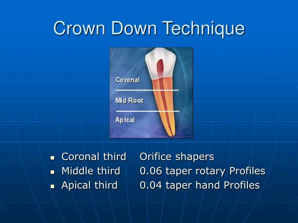 Crown down техника в эндодонтии. Методика crown down в стоматологии. step back и crown down техника. краун даун эндодонтия. техника краун даун в стоматологии.