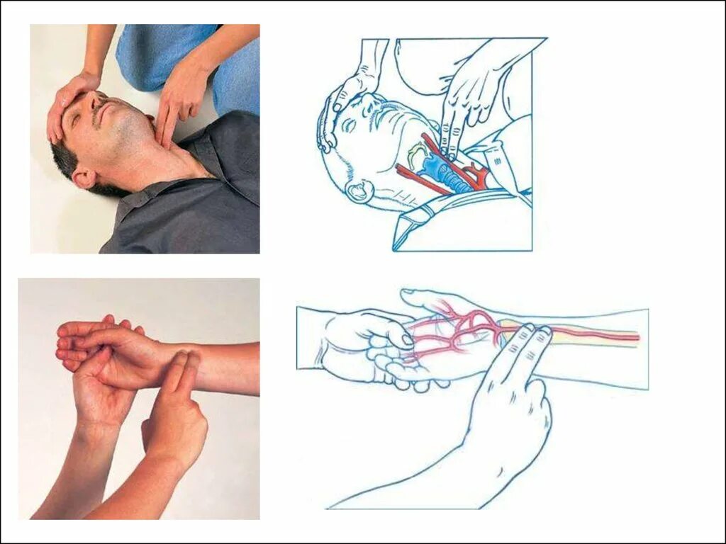 Способы проверки кровообращения. Как определить наличие кровообращения у пострадавшего. Оценка кровообращения у пострадавшего. Проверка пульса у пострадавшего.