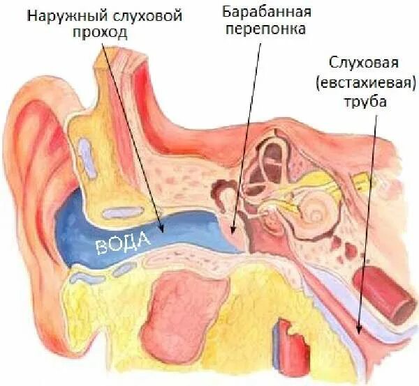 Попадания воды в среднее ухо. Жидкость из среднего уха. После купания болят